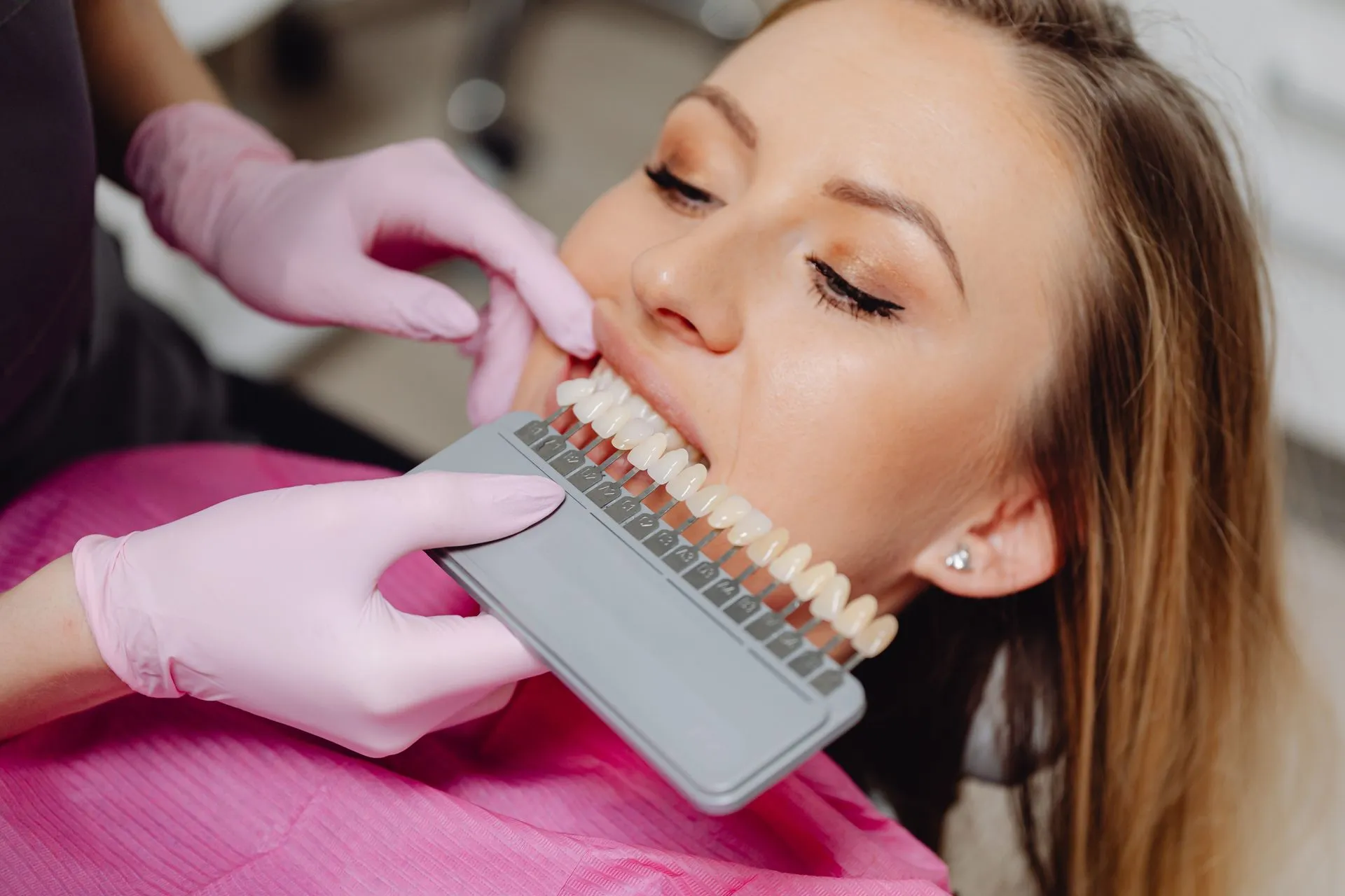 Dentista comparando el color de los dientes de una paciente con una guía de tonos dental