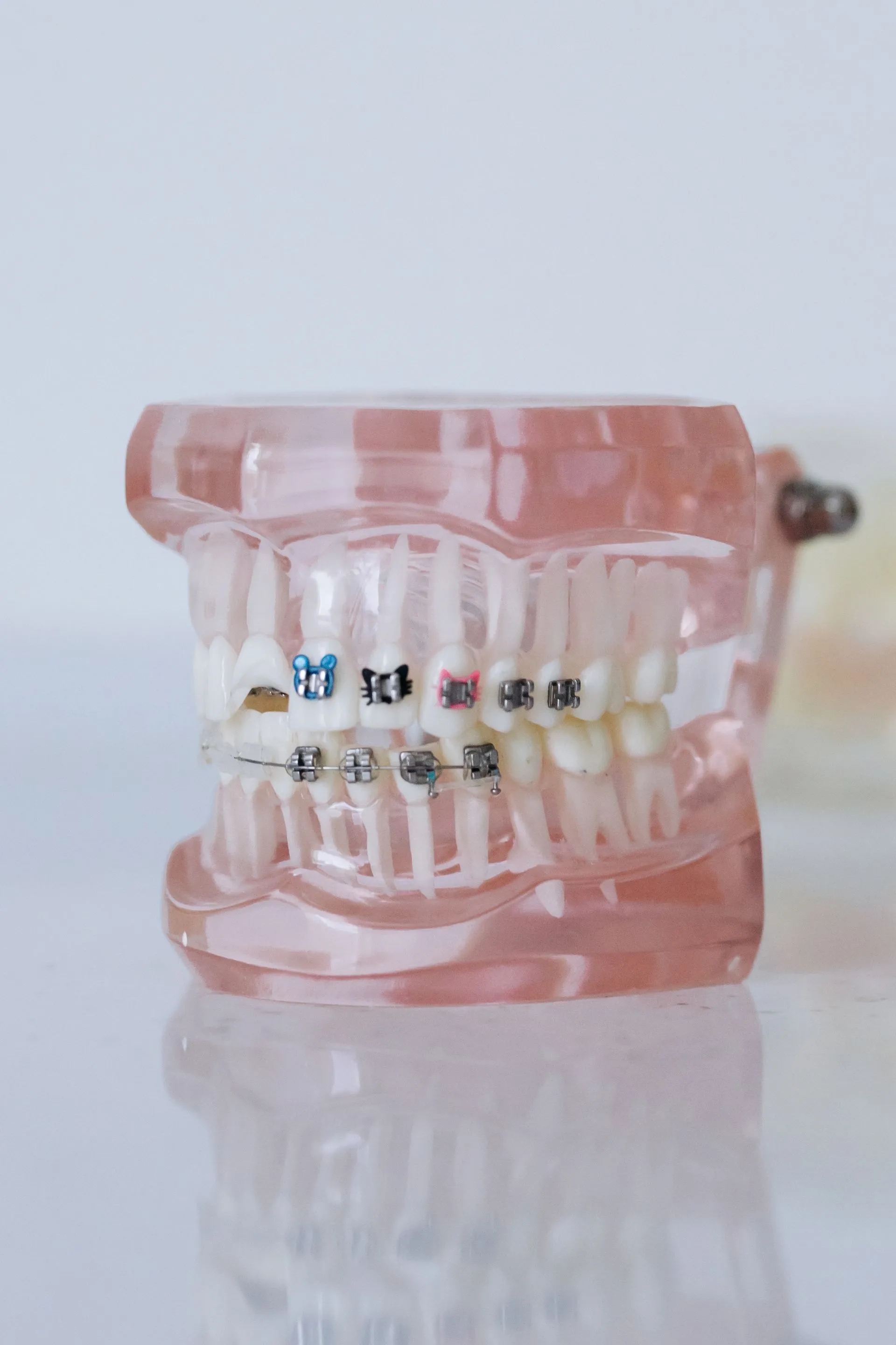 Modelo dental didáctico con brackets de ortodoncia de colores