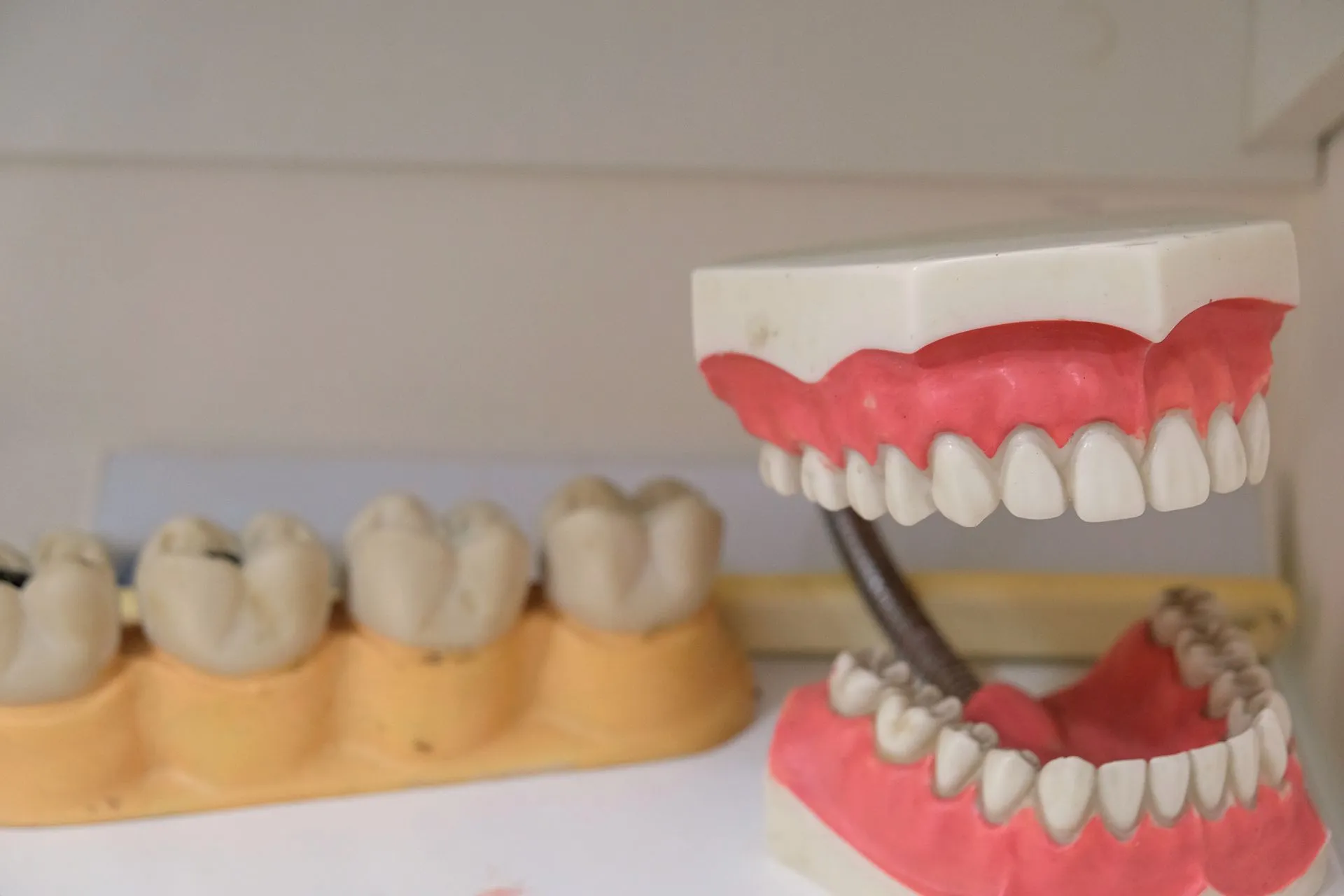 Modelo de prótesis dental completa mostrando la dentadura y la encía